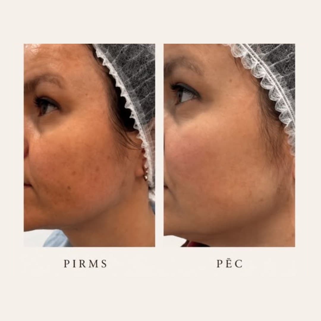 Результат — до и после в клинике LIDERM
